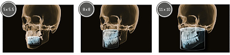 Sirona Orthophos SL 3D (11x10) – Дентальный томограф